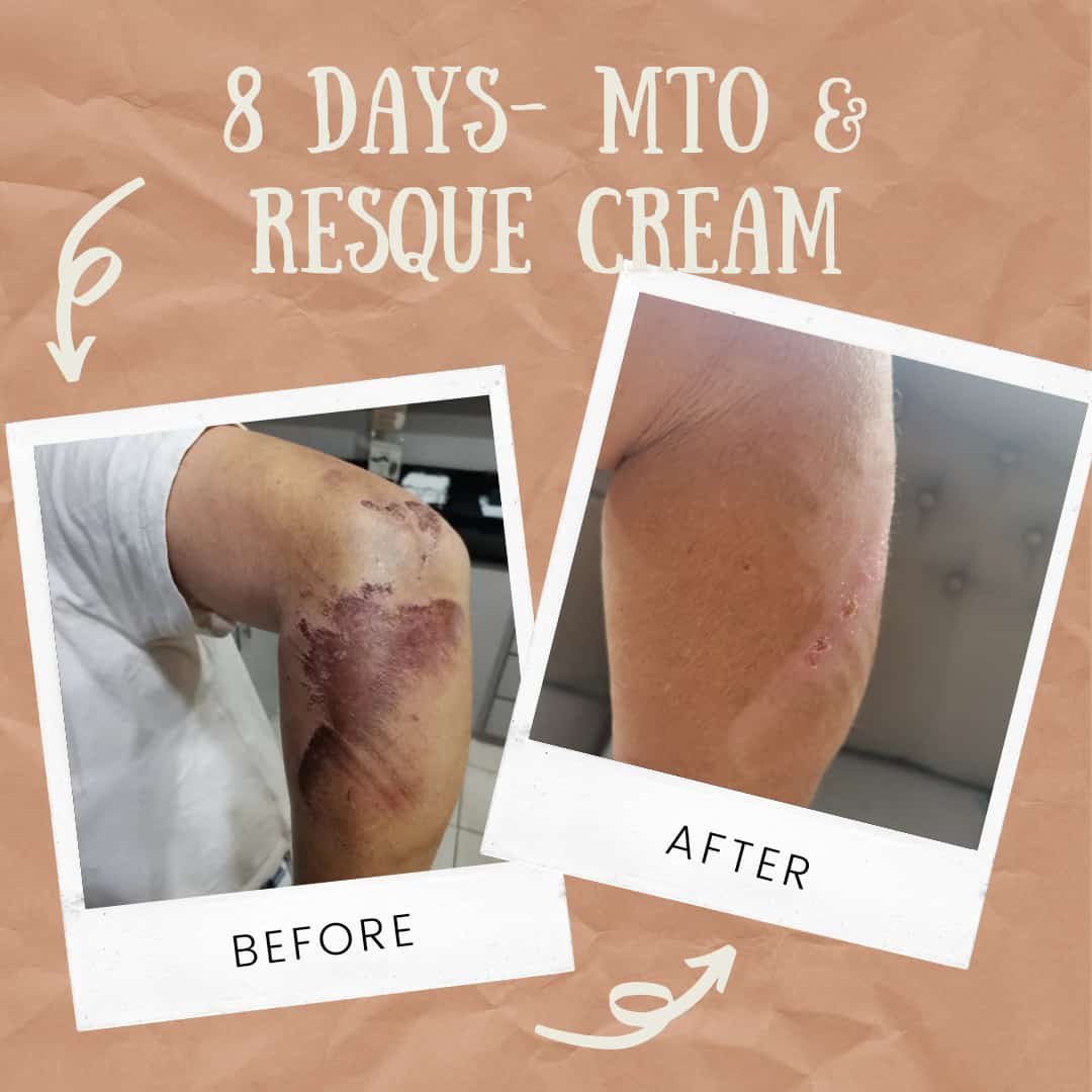 Resque Crème 30ml