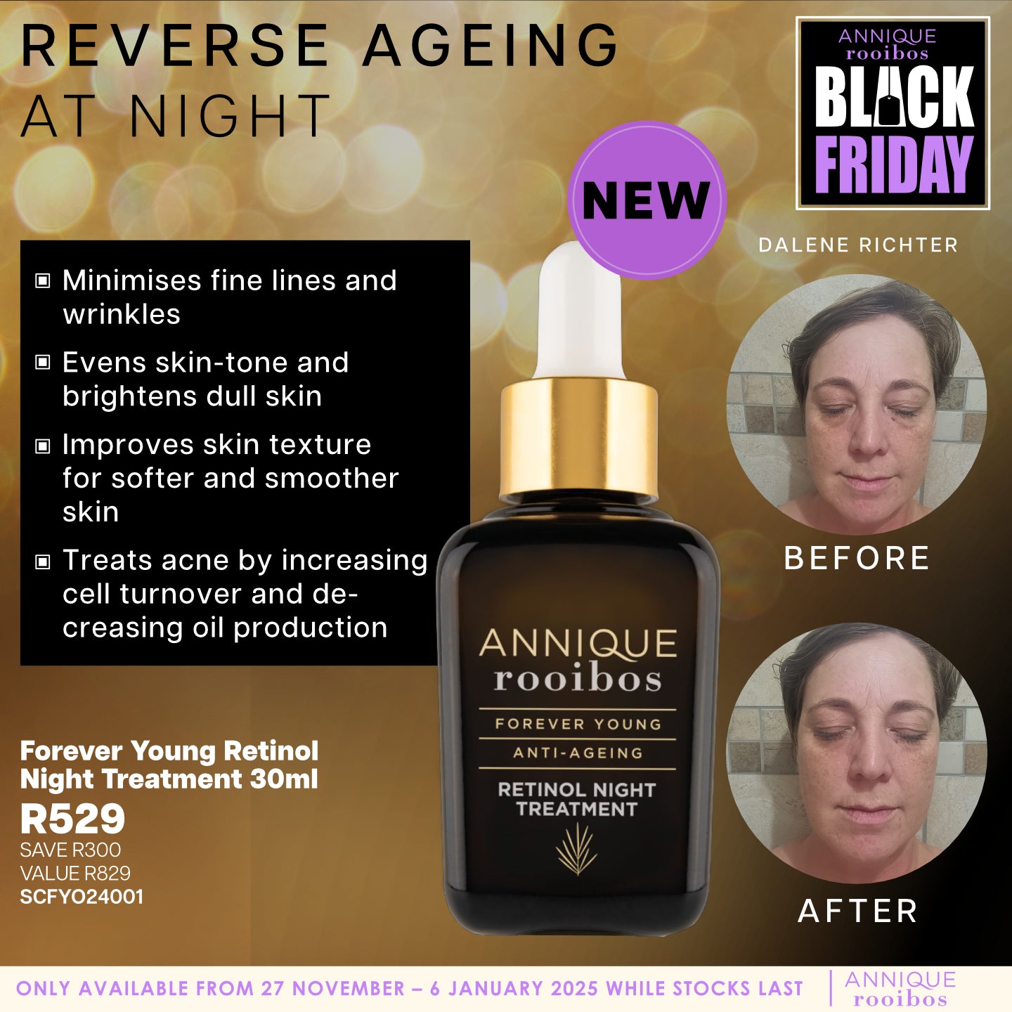 Retinol Night Treatment