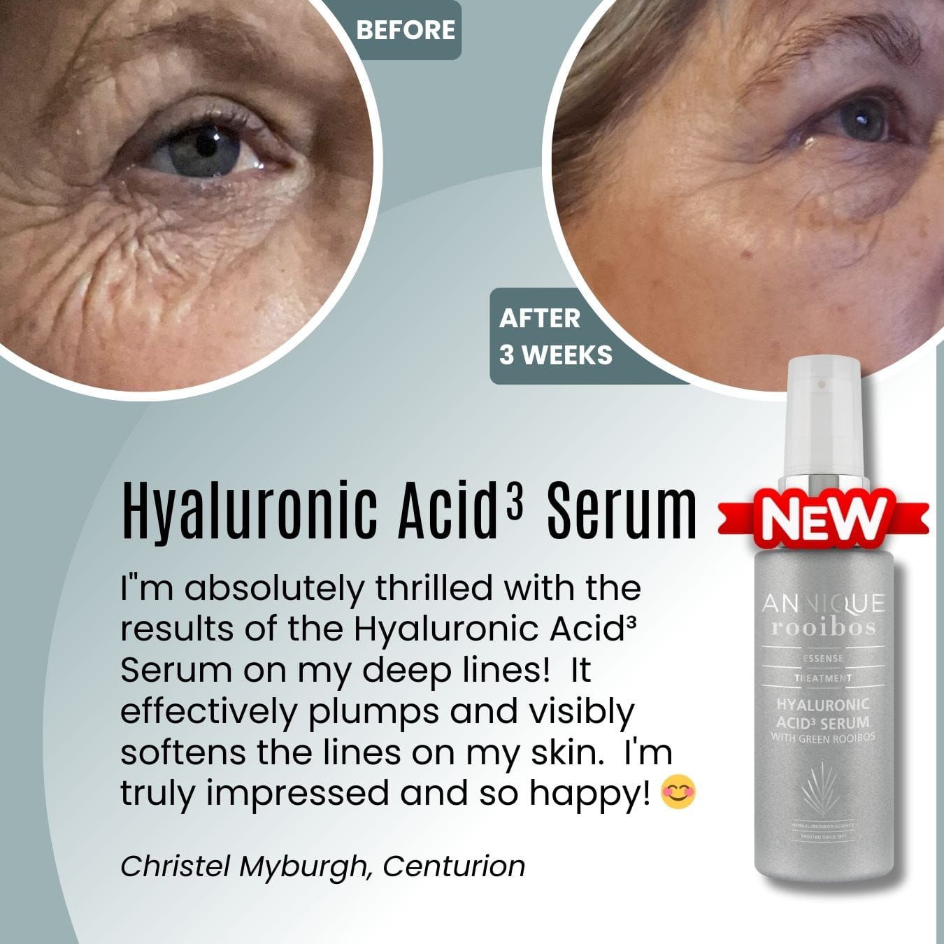 Hyaluronic Acid³ Serum 30ml