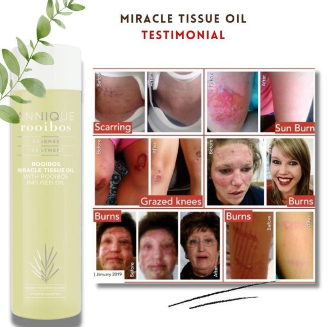Rooibos Miracle Tissue Oil